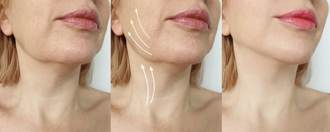 REJUVEN-TONE FACE+CHIN+NECK REJUVENATOR