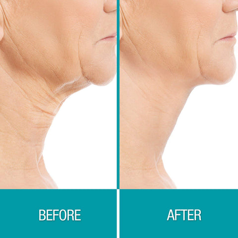 Crepe Gone Facial Souffle Anti Aging Skin Cream