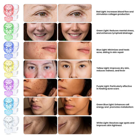 Igia LED Facial Mask – 7-Colour LED Light Therapy for At-Home Skincare
